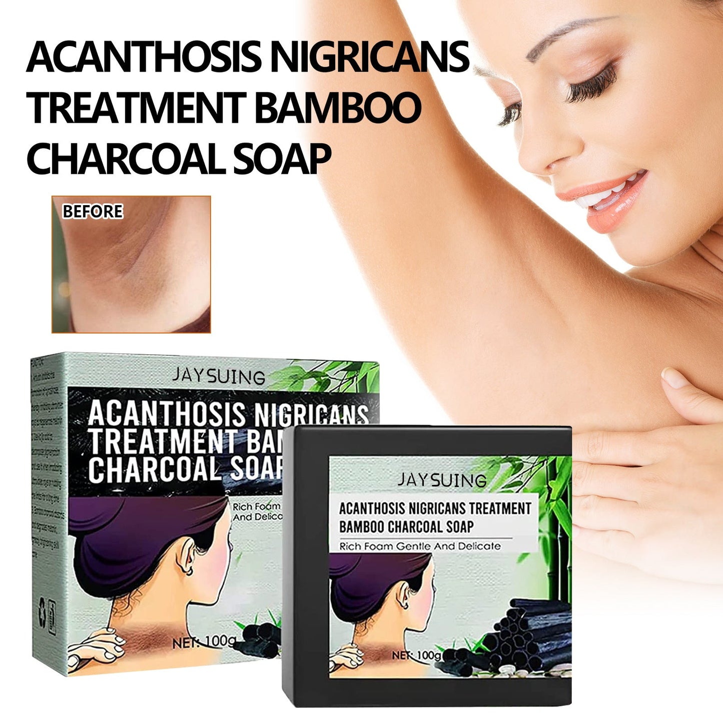 Acanthosis Nigricans Treatment Bamboo Charcoal Soap