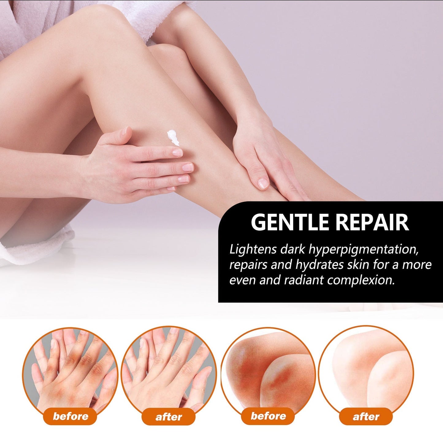 Acanthosis Nigricans Treatment Bamboo Charcoal Soap